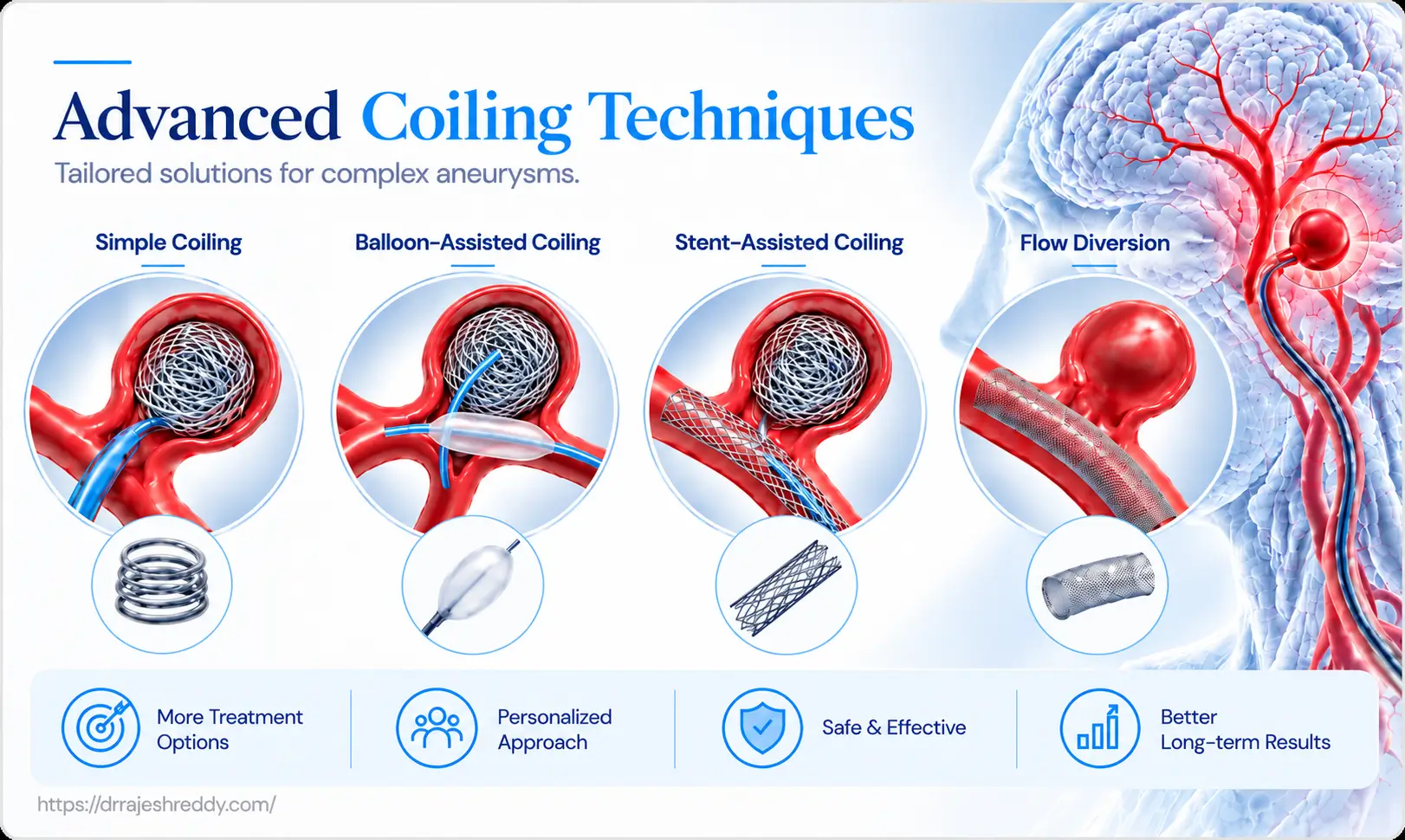 Advanced Endovascular Techniques for Challenging Aneurysms